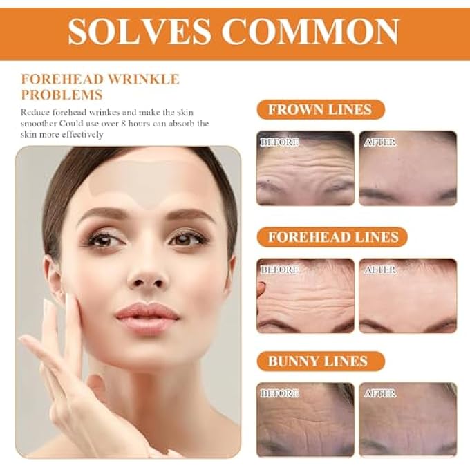 EELHOE PACK OF 30 FOREHEAD MICRONEEDLING FACIAL PATCHES, WRINKLE PLASTERS, KEEPS SKIN MOIST AND SOFT AND FILLS SKIN MOISTURE, SMOOTHS FINE LINES AND WRINKLES - Image 2